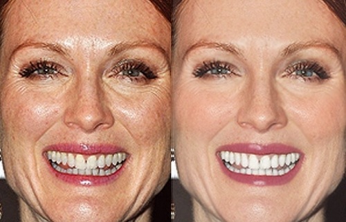 Julianne-Moore-Before-After-Photoshop